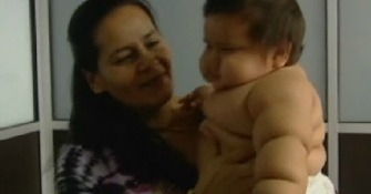 Colombia, il bimbo di 8 mesi| che pesa 21 kg. [VIDEO]