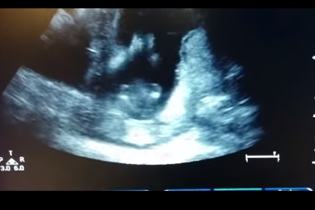 Feto batte le mani a tempo di musica – Video