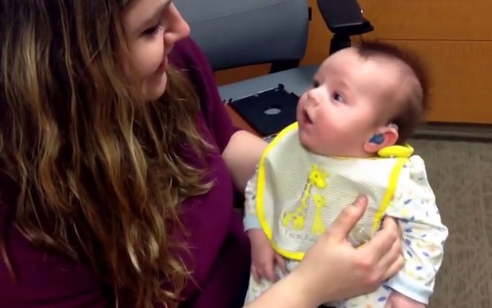 Bimbo sordo sente per la prima volta la voce della mamma