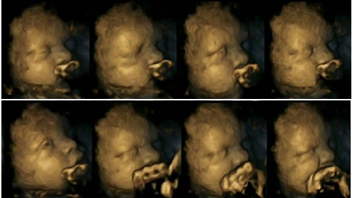 Il fumo fa male al feto, gli effetti nocivi nelle ecografie 4D – Video