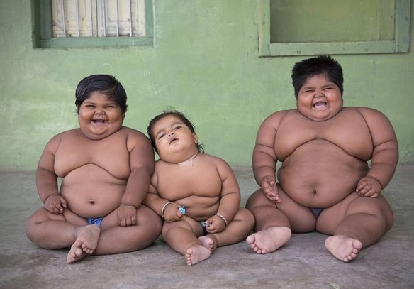 India, padre vende un rene per salvare i tre figli obesi