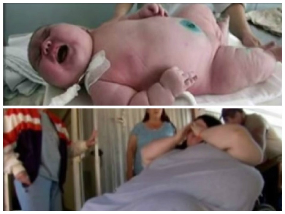 Donna di 272 kg dà alla luce un bambino di 18 kg – Video