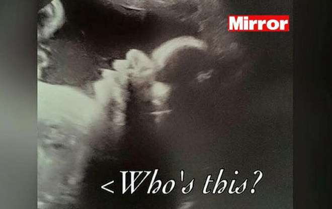 Futura mamma fa un’ecografia, ma quello che vede è inquietante