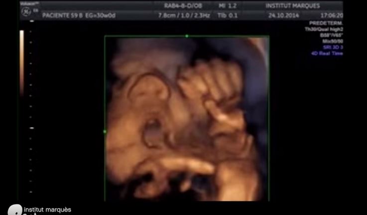 Il feto canta Bach nel pancione, ecco il video che impazza sul web