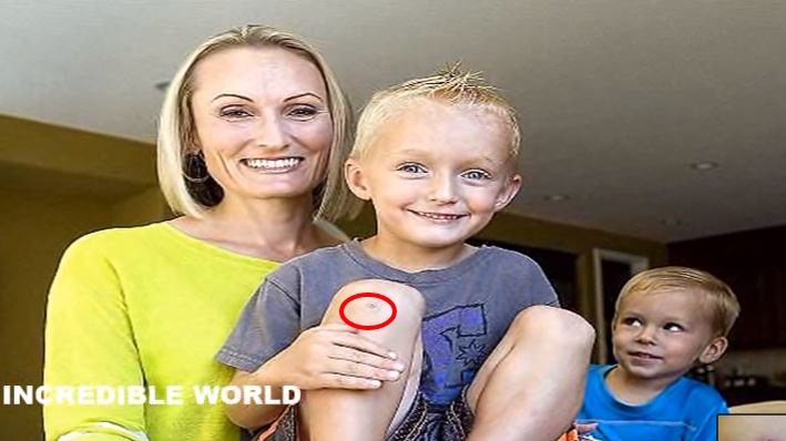 Il ginocchio del bambino si infetta e cresce a dismisura, il perchè è scioccante