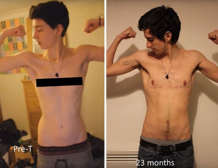 Da donna a uomo, la trasformazione di Jamie in timelapse