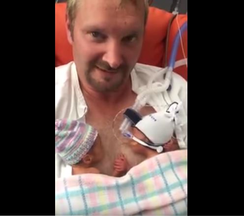 I gemellini nati prematuri si fanno forza tenendosi per mano – Video