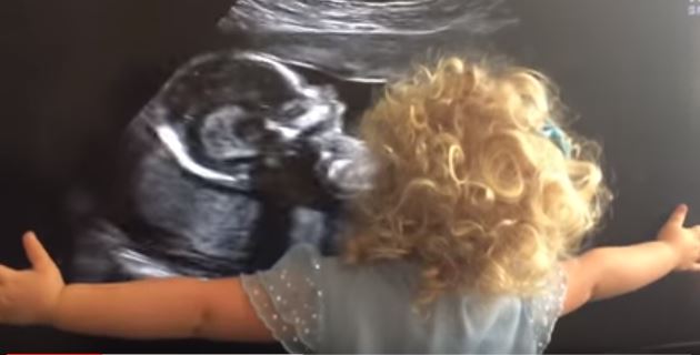A tre anni vede l’ecografia della sorellina: la reazione è commovente