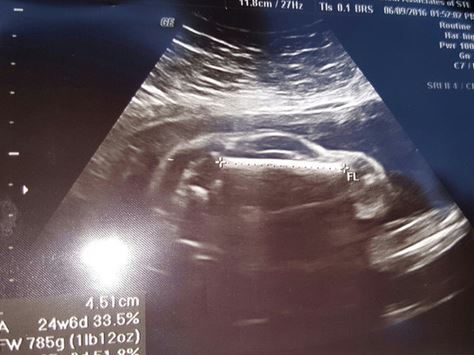 Donna incinta fa un’ecografia, ciò che appare è incredibile