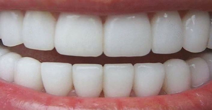 Più denti si perdono, meno si vive: lo dice una ricerca