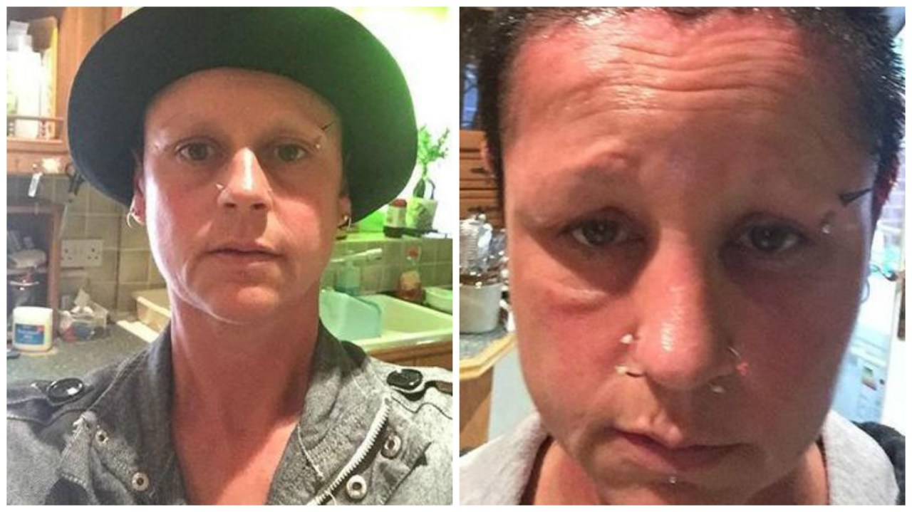 Si tinge i capelli in casa, un’ora dopo la spaventosa reazione