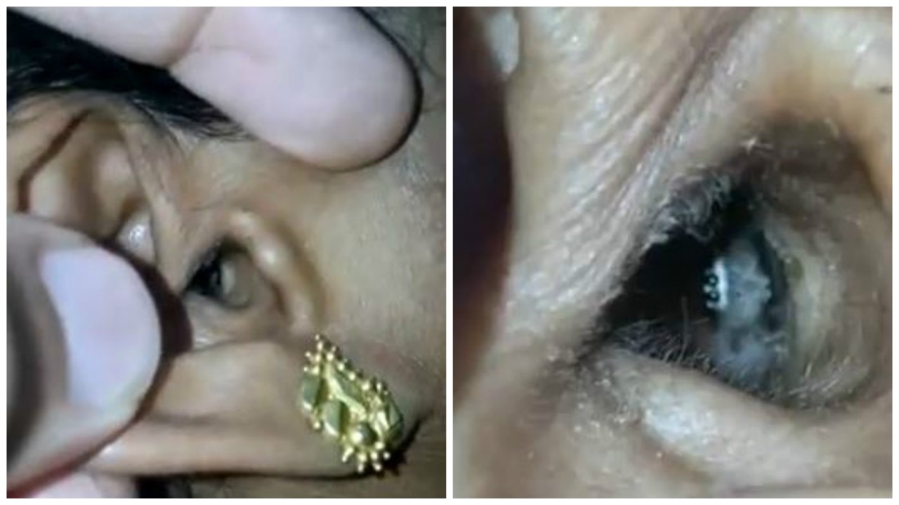 Va in ospedale a causa di un forte mal di testa, la scoperta choc dei medici