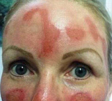 “Sentivo puzza di carne bruciata”, il dramma di Deborah fa il giro del mondo