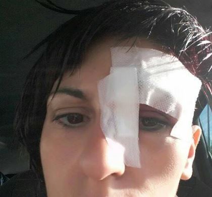 “Un topo di fogna mi è entrato in casa e mi ha ridotta così”, il racconto choc di una donna