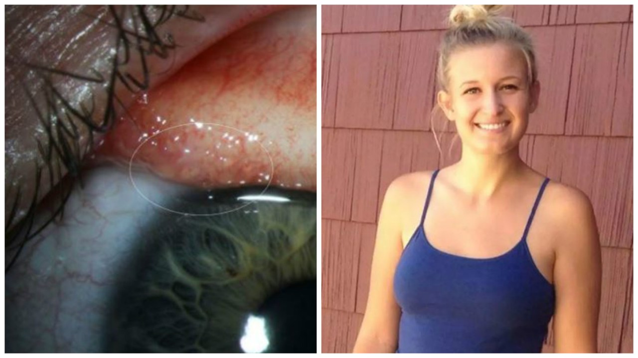 Le brucia l’occhio, la scoperta choc davanti allo specchio: “C’è qualcosa che si muove”