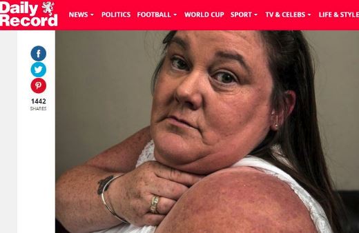 Mangiata dalla cimici in vacanza: aveva sborsato 1.300 euro per uno chalet di lusso