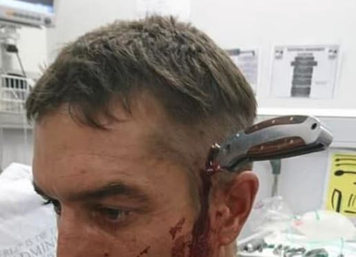 “C’è un dottore libero?”, ciclista in ospedale con un coltello conficcato in testa