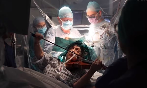 Suona il violino mentre viene operata per un tumore al cervello – Video