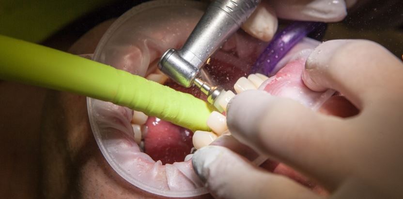 Strutture sanitarie piene per il Covid, beve otto birre e si estrae due denti da solo