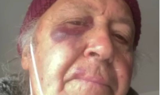 Il padre della nota cantante picchiato selvaggiamente