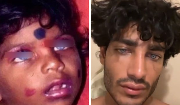 Akash: “Eccomi da bambino” (con gli occhi azzurri). Ma la foto è su Google da anni