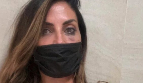 Guendalina Tavassi vittima di un’aggressione: “Sono ancora sconvolta”
