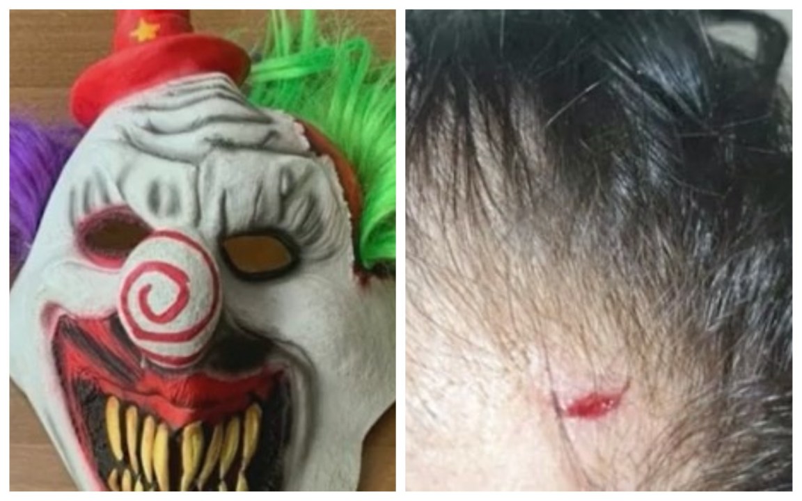 La notte horror di Cristina: “Presa a martellate in casa da un clown”