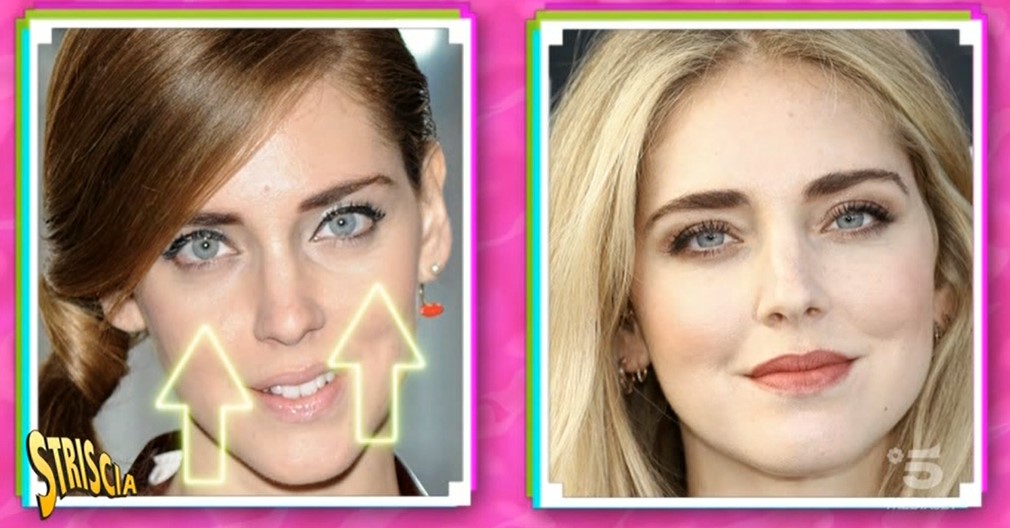 Chiara Ferragni è rifatta? La regina delle influencer nel mirino di “Striscia”