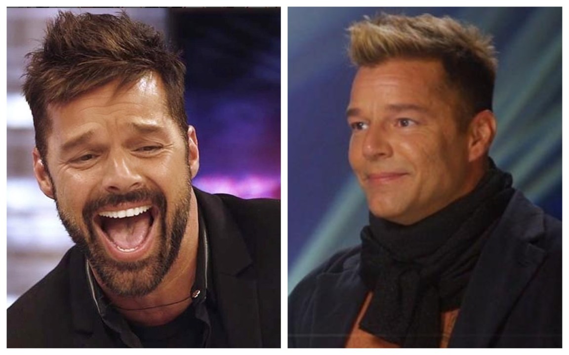 Ricky Martin irriconoscibile: “Non ho usato il botox, ecco cosa mi è successo”