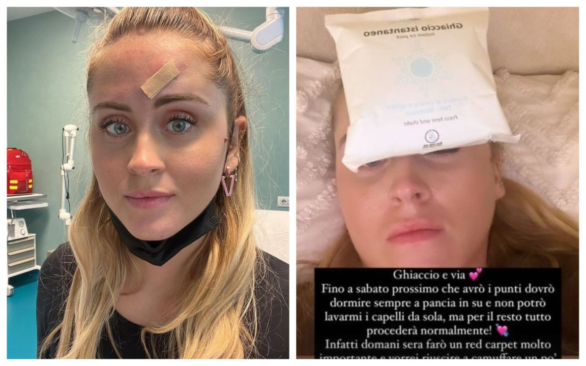 Valentina Ferragni operata al viso: “Ho tolto quella ‘cosa’, l’avevo da un anno”