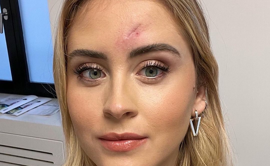 Valentina Ferragni, la diagnosi dopo l’intervento al viso: “Tumore maligno”