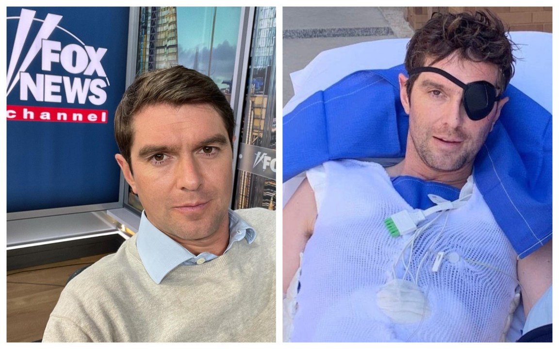 Benjamin Hall, il reporter di Fox News ferito in Ucraina: “Ho perso mezza gamba e un piede”