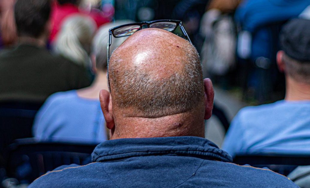 “Definire ‘pelato’ un uomo è molestia sessuale”, la sentenza che fa discutere