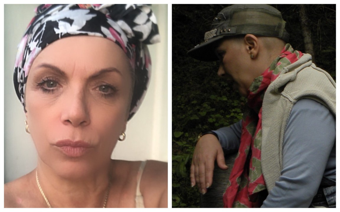 Il doloroso ricordo di Rosanna Banfi: “In questa foto non mi riconosco in nulla”