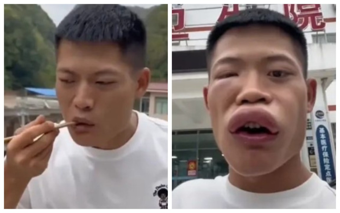 Influencer mangia una vespa viva e posta il video sui social: è polemica