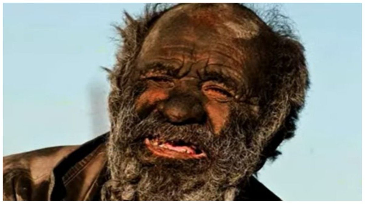 Morto l’uomo più sporco del mondo: non si lavava da più di 60 anni