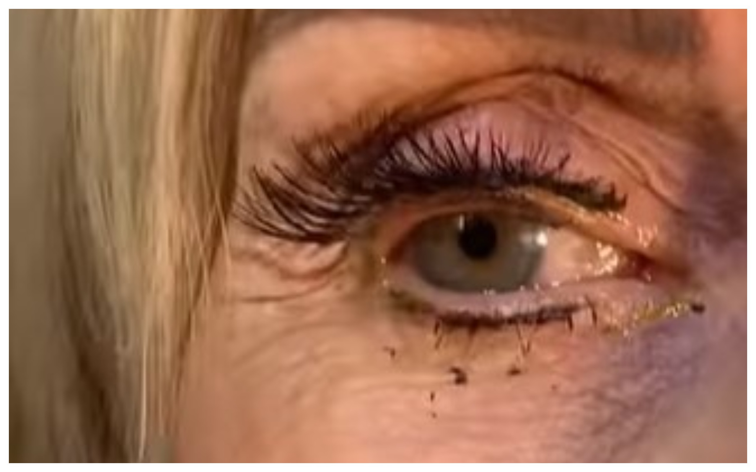 Va dall’oculista per un dolore agli occhi, la scoperta choc: “Aveva 23 lenti a contatto”