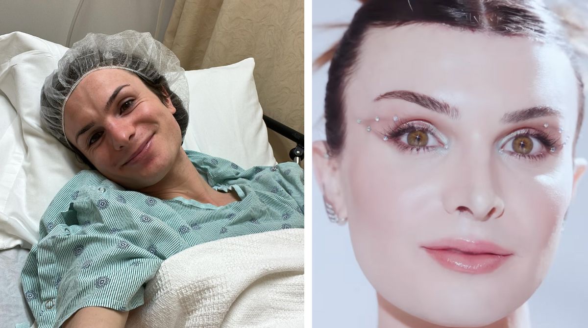 Tiktoker transgender trasforma il suo volto grazie alla chirurgia