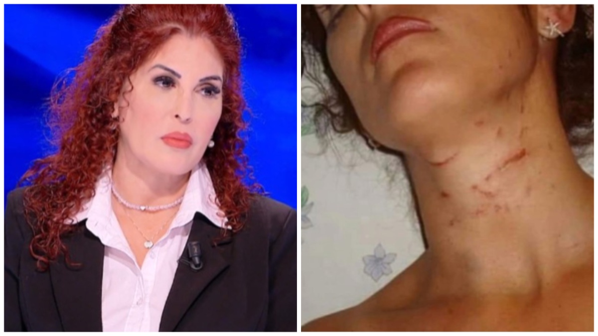 Lidia Vivoli, la palermitana scampata ad un femminicidio: “Ho lottato per vivere”