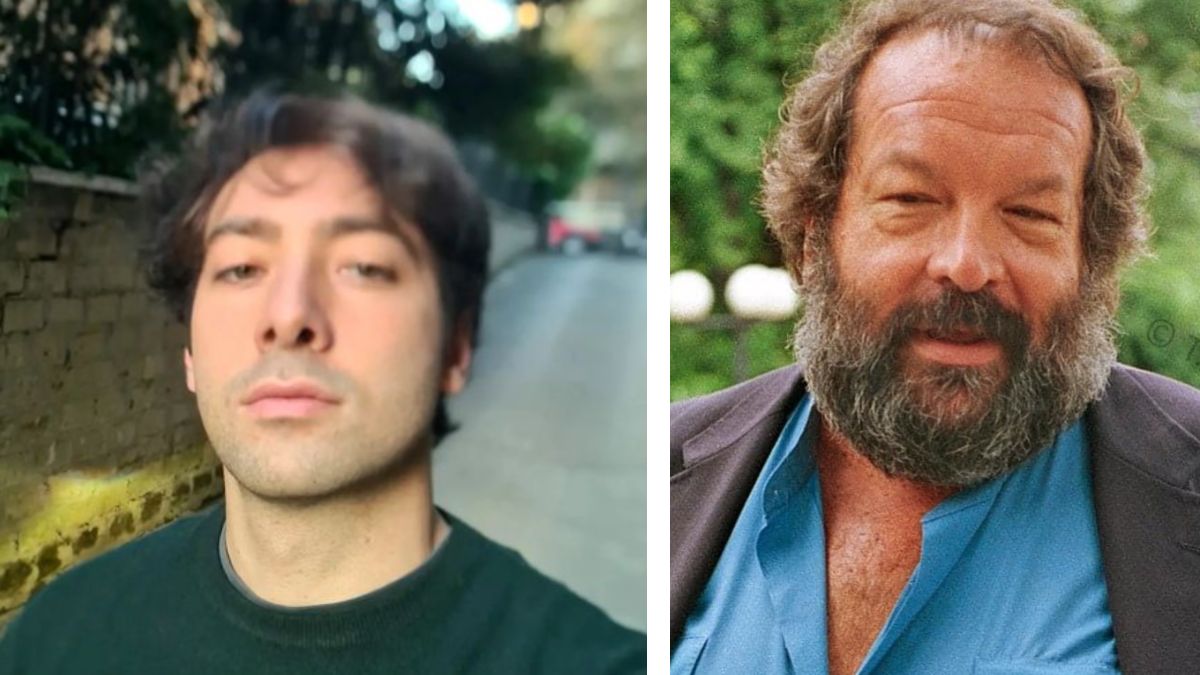 Nipote di Bud Spencer preso a pugni in faccia: tre denti rotti e diverse fratture al volto