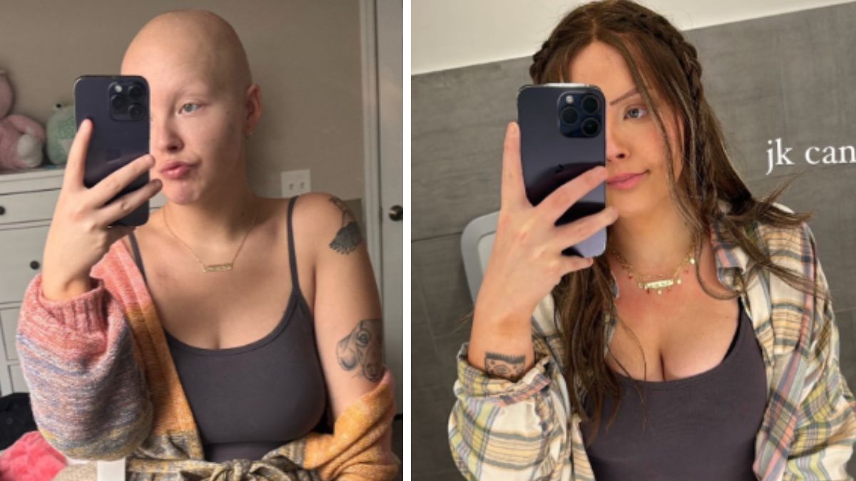 Morta a 26 anni Maddy Baloy, la tiktoker ha raccontato la sua lotta contro il cancro sui social
